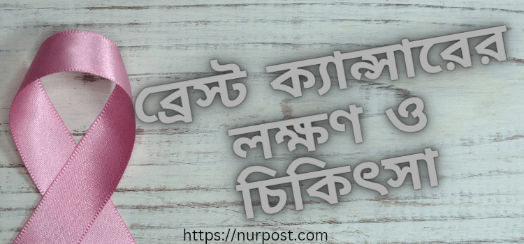 ব্রেস্ট ক্যান্সারের লক্ষণ ও চিকিৎসা ব্রেস্ট ক্যান্সারের লক্ষণ ও চিকিৎসা