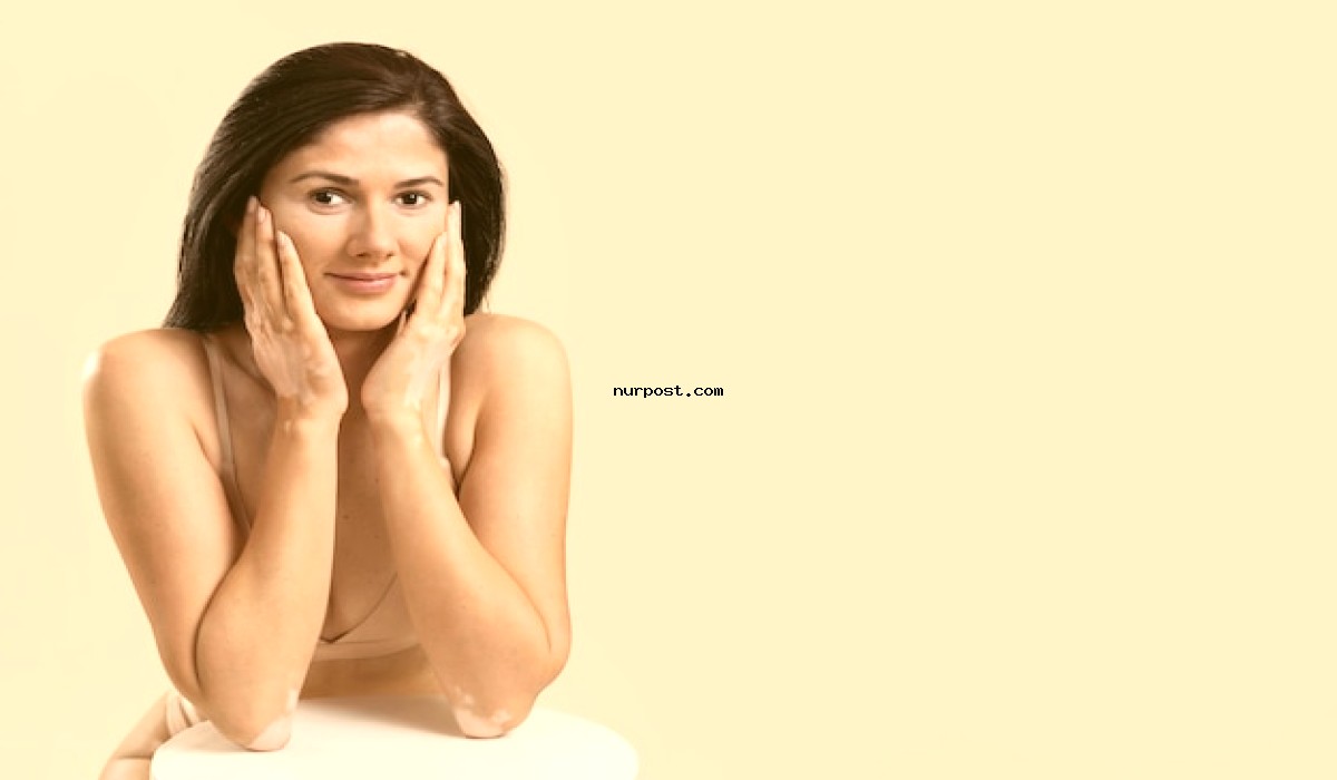 চামড়া টাইট করার উপায়: প্রাকৃতিক এবং কৃত্রিম উপায় (সম্পুর্ণ গাইড) চামড়া টাইট করার উপায়: প্রাকৃতিক এবং কৃত্রিম উপায়